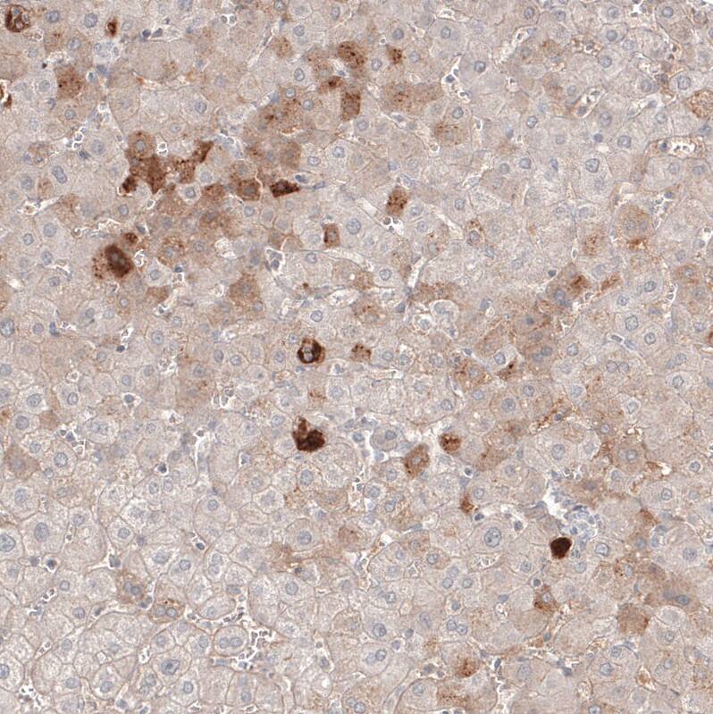 Serum Amyloid A1 Antibody (CL9175) - Azide and BSA Free Immunohistochemistry-Paraffin: Serum Amyloid A1 Antibody [NBP3-44275]