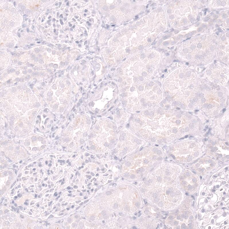 CD19 Antibody (CL15454) - Azide and BSA Free Immunohistochemistry-Paraffin: CD19 Antibody [NBP3-44277]