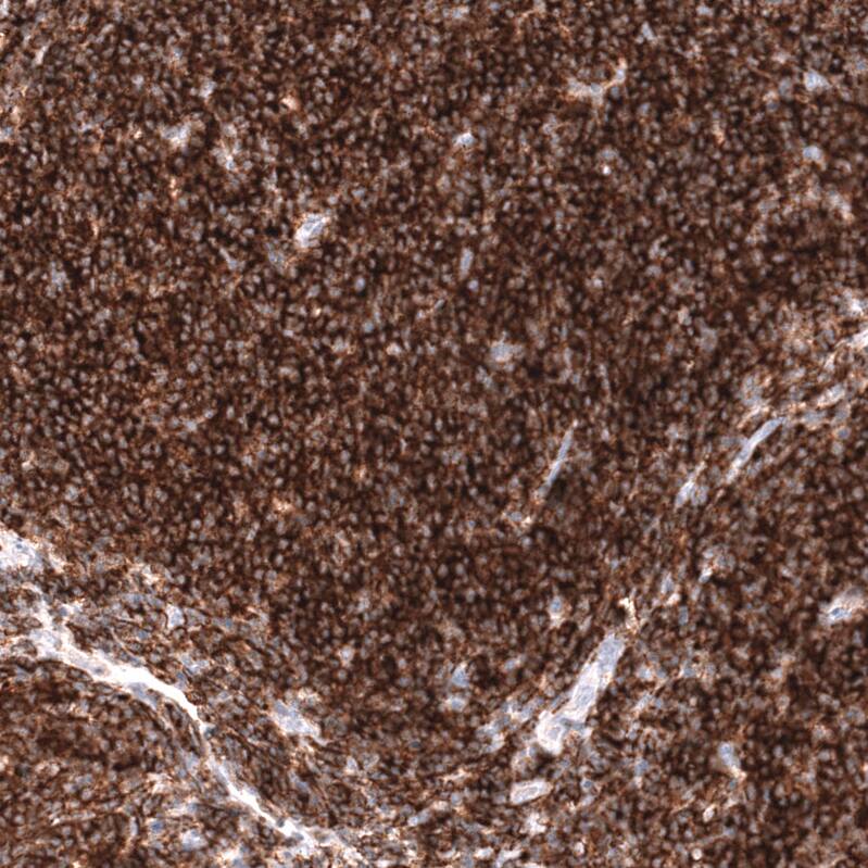 CD19 Antibody (CL15454) - Azide and BSA Free Immunohistochemistry-Paraffin: CD19 Antibody [NBP3-44277]