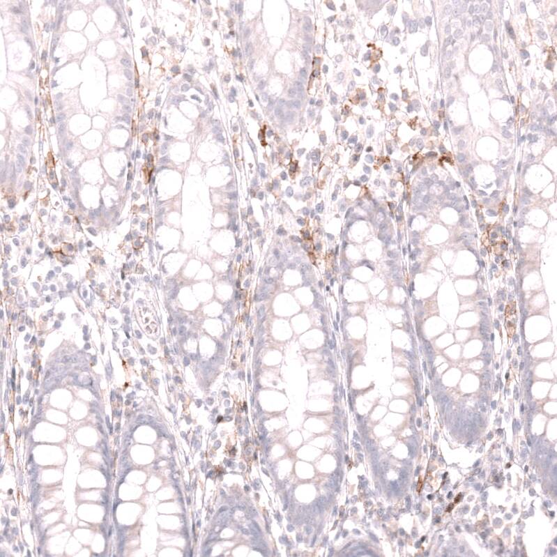 CD19 Antibody (CL15454) - Azide and BSA Free Immunohistochemistry-Paraffin: CD19 Antibody [NBP3-44277]