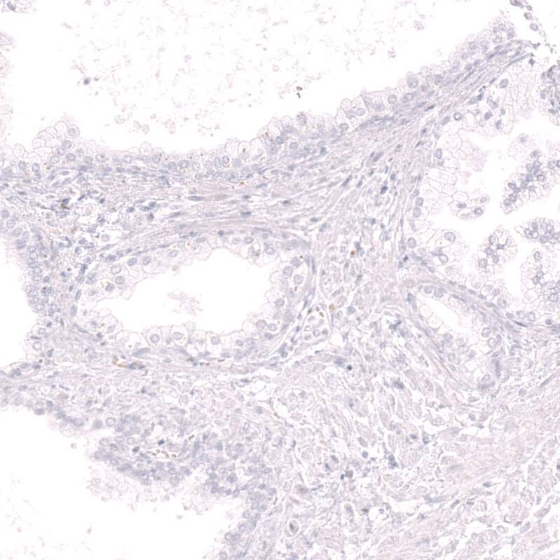 CD19 Antibody (CL15459) - Azide and BSA Free Immunohistochemistry-Paraffin: CD19 Antibody [NBP3-44278]