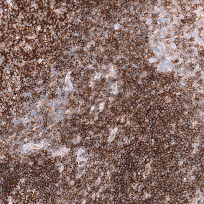CD19 Antibody (CL15459) - Azide and BSA Free Immunohistochemistry-Paraffin: CD19 Antibody [NBP3-44278]