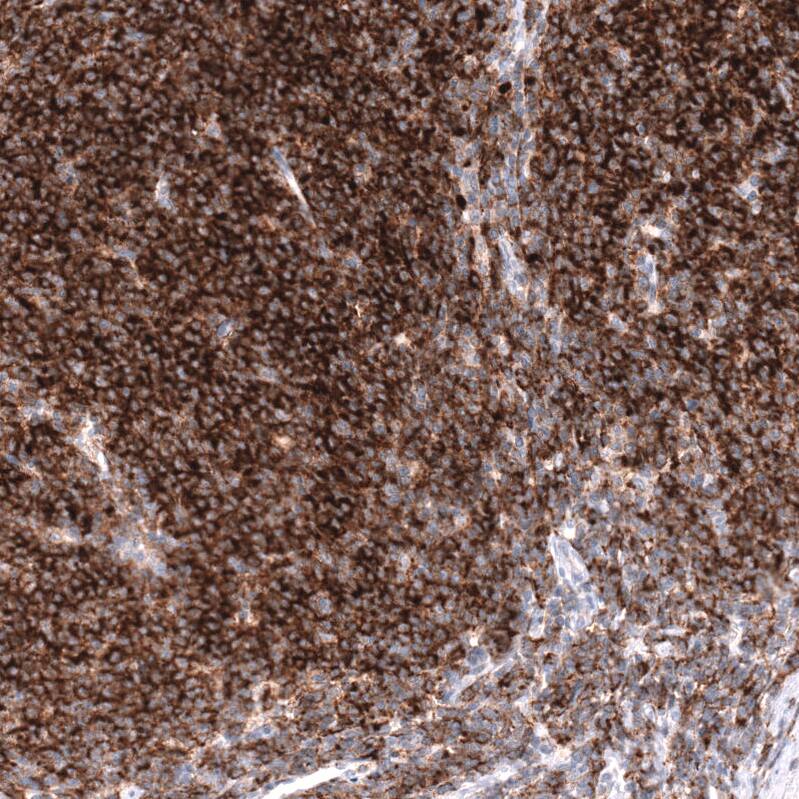 CD19 Antibody (CL15459) - Azide and BSA Free Immunohistochemistry-Paraffin: CD19 Antibody [NBP3-44278]
