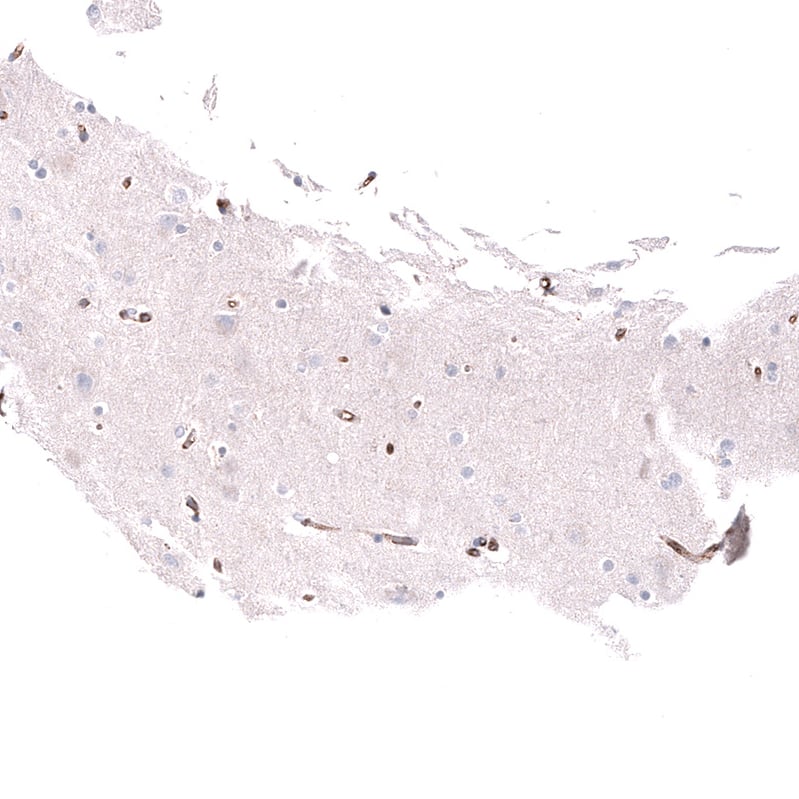 CD31/PECAM-1 Antibody (CL14696) - Azide and BSA Free Immunohistochemistry-Paraffin: CD31/PECAM-1 Antibody [NBP3-44281]