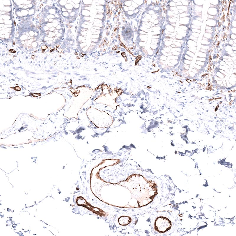 CD31/PECAM-1 Antibody (CL14696) - Azide and BSA Free Immunohistochemistry-Paraffin: CD31/PECAM-1 Antibody [NBP3-44281]