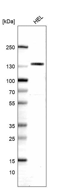 CD31/PECAM-1 Antibody (CL14696) - Azide and BSA Free Western Blot: CD31/PECAM-1 Antibody [NBP3-44281]