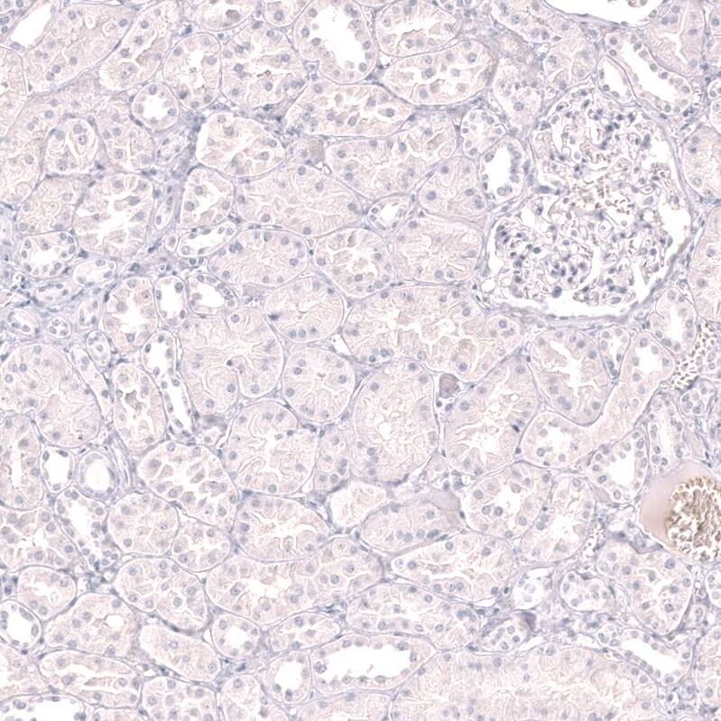 LAG-3 Antibody (CL14773) - Azide and BSA Free Immunohistochemistry-Paraffin: LAG-3 Antibody [NBP3-44285]