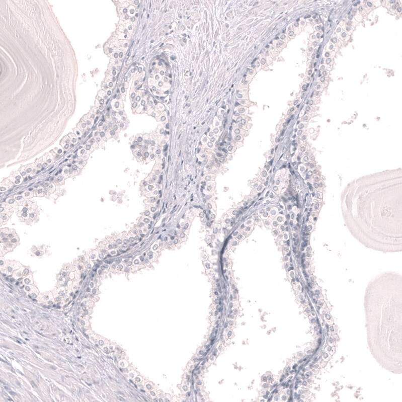 LAG-3 Antibody (CL14773) - Azide and BSA Free Immunohistochemistry-Paraffin: LAG-3 Antibody [NBP3-44285]