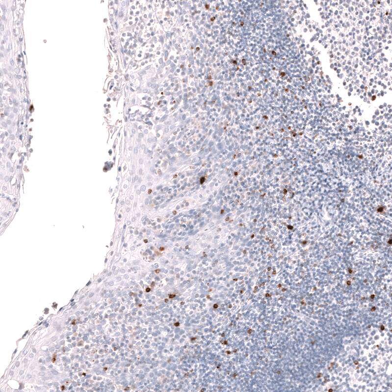 LAG-3 Antibody (CL14773) - Azide and BSA Free Immunohistochemistry-Paraffin: LAG-3 Antibody [NBP3-44285]