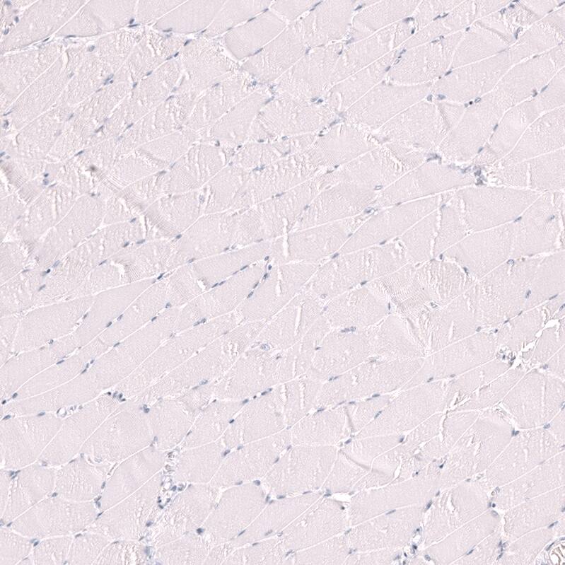 LAG-3 Antibody (CL14773) - Azide and BSA Free Immunohistochemistry-Paraffin: LAG-3 Antibody [NBP3-44285]