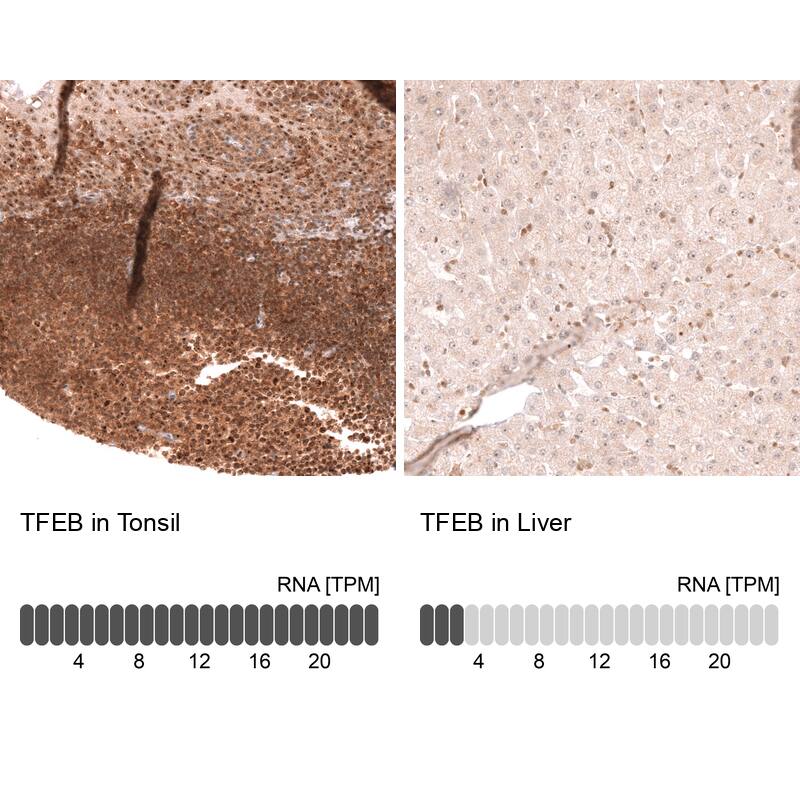 TFEB Antibody (CL14112) - Azide and BSA Free Immunohistochemistry-Paraffin: TFEB Antibody [NBP3-44287]