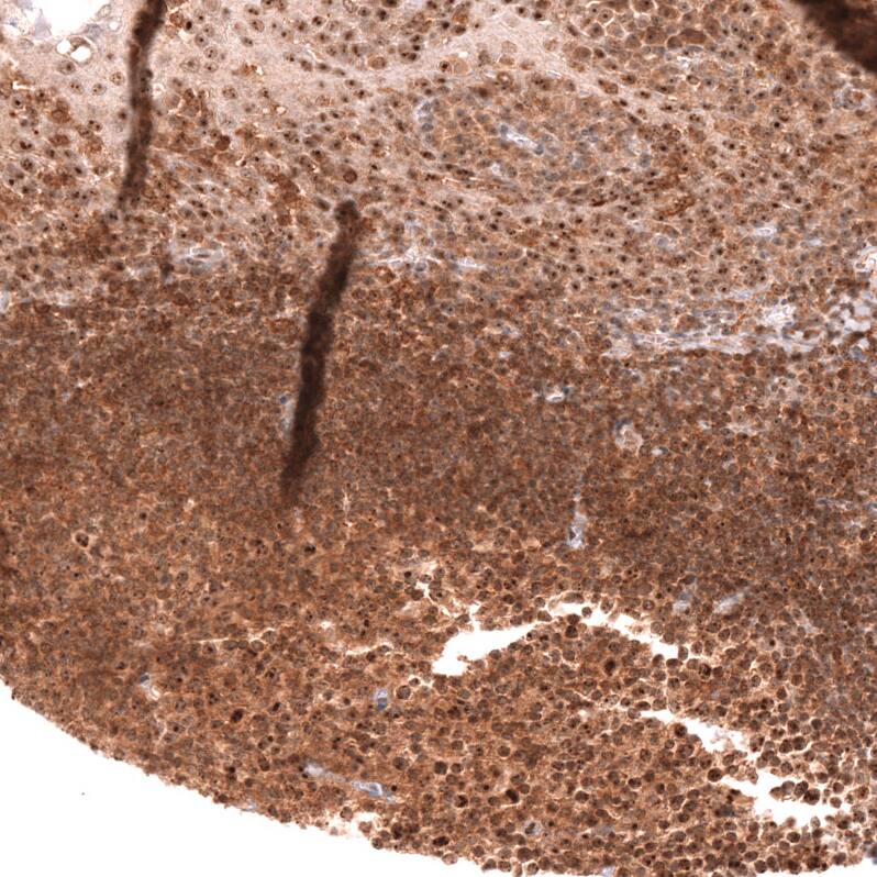 TFEB Antibody (CL14112) - Azide and BSA Free Immunohistochemistry-Paraffin: TFEB Antibody [NBP3-44287]