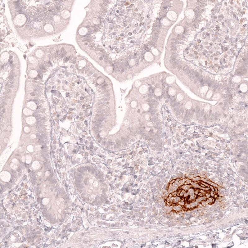 CD21 Antibody (CL14556) - Azide and BSA Free Immunohistochemistry-Paraffin: CD21 Antibody [NBP3-44289]