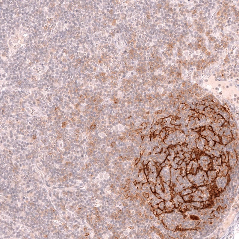 CD21 Antibody (CL14556) - Azide and BSA Free Immunohistochemistry-Paraffin: CD21 Antibody [NBP3-44289]