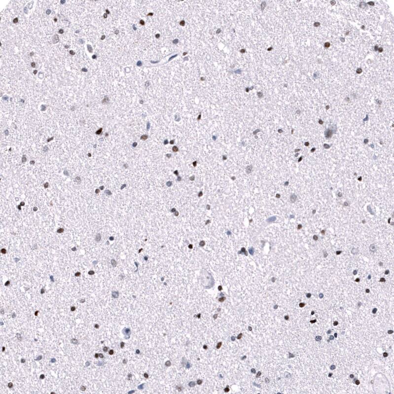 POU3F3 Antibody (CL15302) - Azide and BSA Free Immunohistochemistry-Paraffin: POU3F3 Antibody [NBP3-44291]