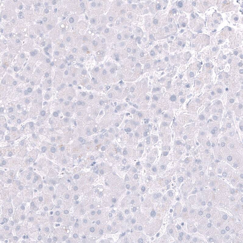 POU3F3 Antibody (CL15302) - Azide and BSA Free Immunohistochemistry-Paraffin: POU3F3 Antibody [NBP3-44291]