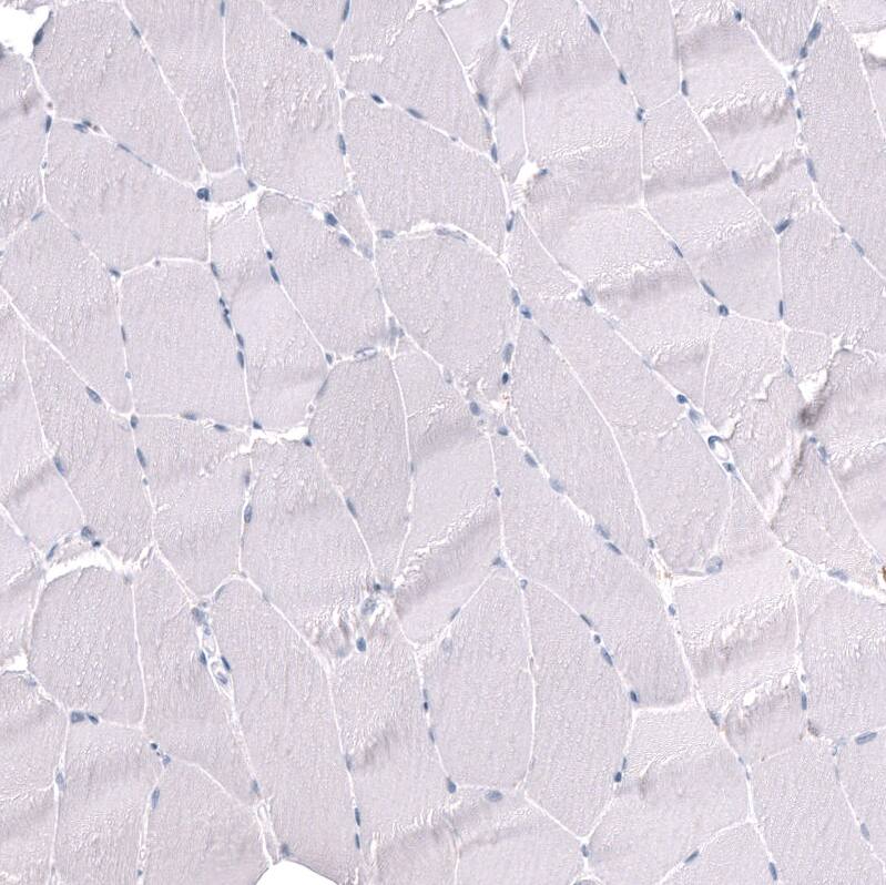 POU3F3 Antibody (CL15302) - Azide and BSA Free Immunohistochemistry-Paraffin: POU3F3 Antibody [NBP3-44291]