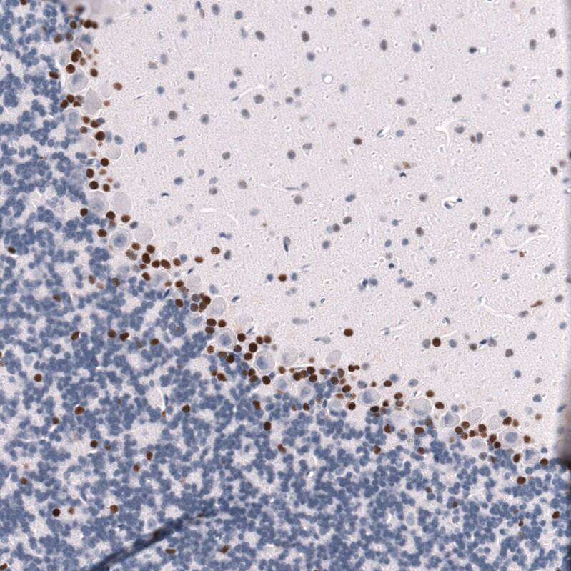 POU3F3 Antibody (CL15302) - Azide and BSA Free Immunohistochemistry-Paraffin: POU3F3 Antibody [NBP3-44291]