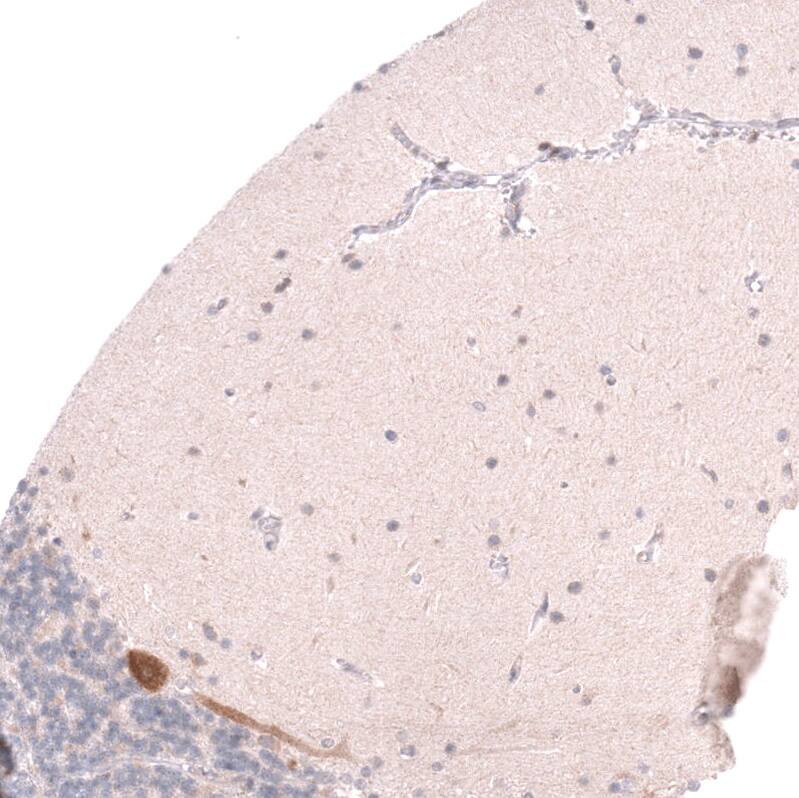 Pleiotrophin/PTN Antibody (CL15628) - Azide and BSA Free Immunohistochemistry-Paraffin: Pleiotrophin/PTN Antibody [NBP3-44293]