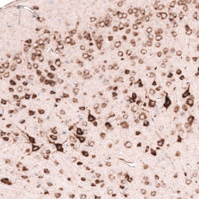 Pleiotrophin/PTN Antibody (CL15628) - Azide and BSA Free Immunohistochemistry-Paraffin: Pleiotrophin/PTN Antibody [NBP3-44293]