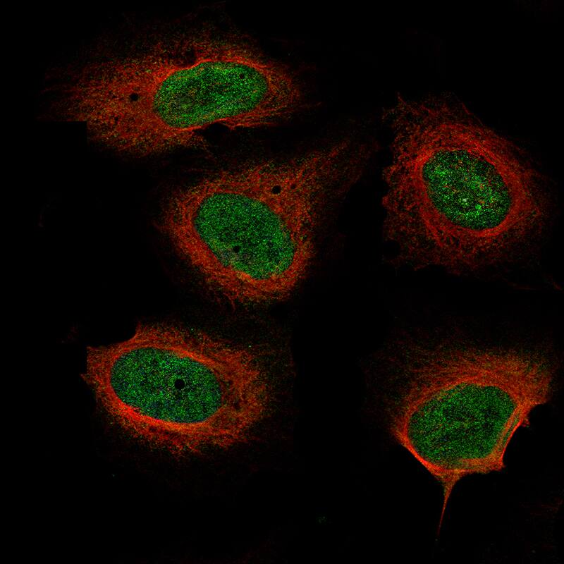 Neurofibromin 1 Antibody (CL11773) - Azide and BSA Free Immunocytochemistry/ Immunofluorescence: Neurofibromin 1 Antibody [NBP3-44294]