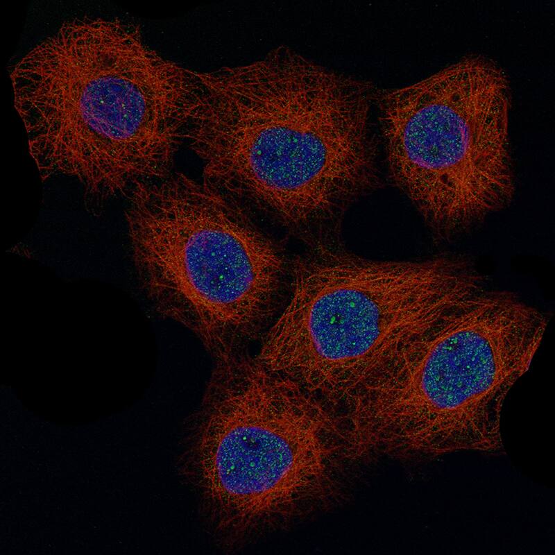 Cyclin D1 Antibody (CL12328) - Azide and BSA Free Immunocytochemistry/ Immunofluorescence: Cyclin D1 Antibody [NBP3-44296]