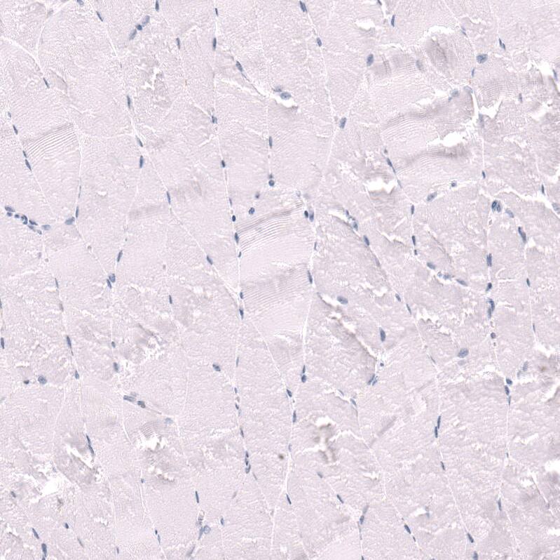 CD27/TNFRSF7 Antibody (CL15464) - Azide and BSA Free Immunohistochemistry-Paraffin: CD27/TNFRSF7 Antibody [NBP3-44297]