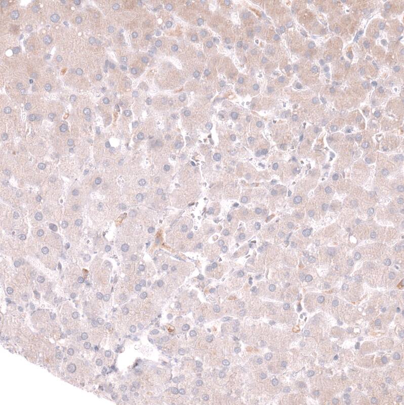 CD27/TNFRSF7 Antibody (CL15464) - Azide and BSA Free Immunohistochemistry-Paraffin: CD27/TNFRSF7 Antibody [NBP3-44297]