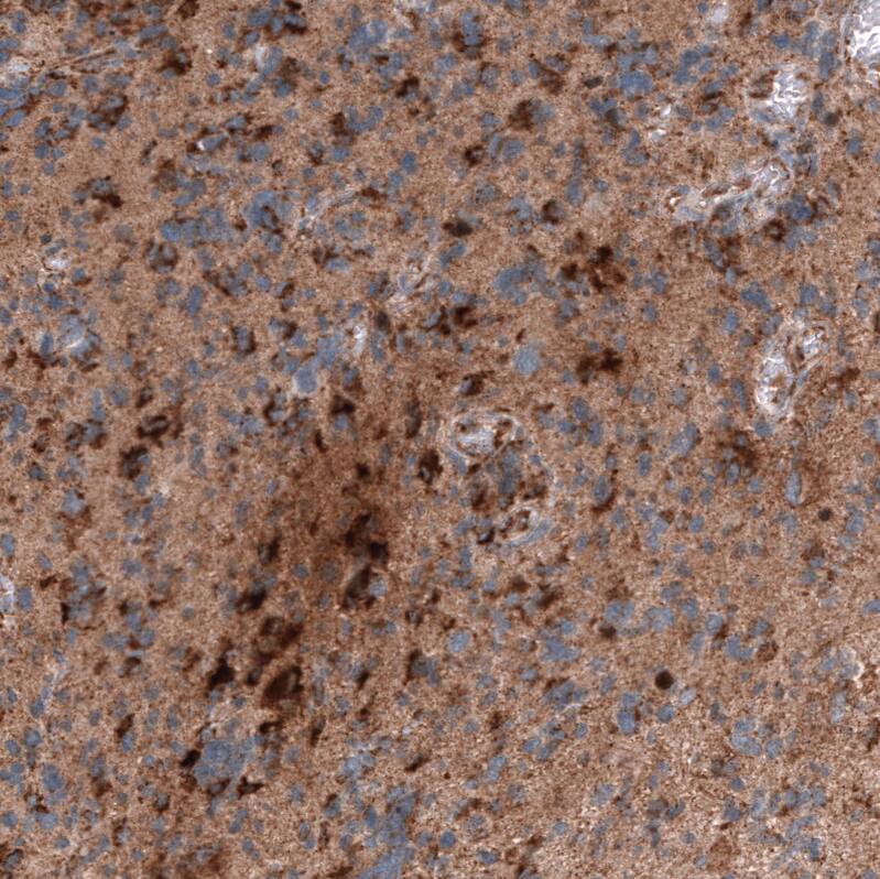 Chitinase 3-like 1/YKL-40 Antibody (CL12241) - Azide and BSA Free Immunohistochemistry-Paraffin: Chitinase 3-like 1/YKL-40 Antibody [NBP3-44298]
