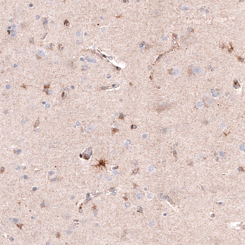 Chitinase 3-like 1/YKL-40 Antibody (CL12241) - Azide and BSA Free Immunohistochemistry-Paraffin: Chitinase 3-like 1/YKL-40 Antibody [NBP3-44298]