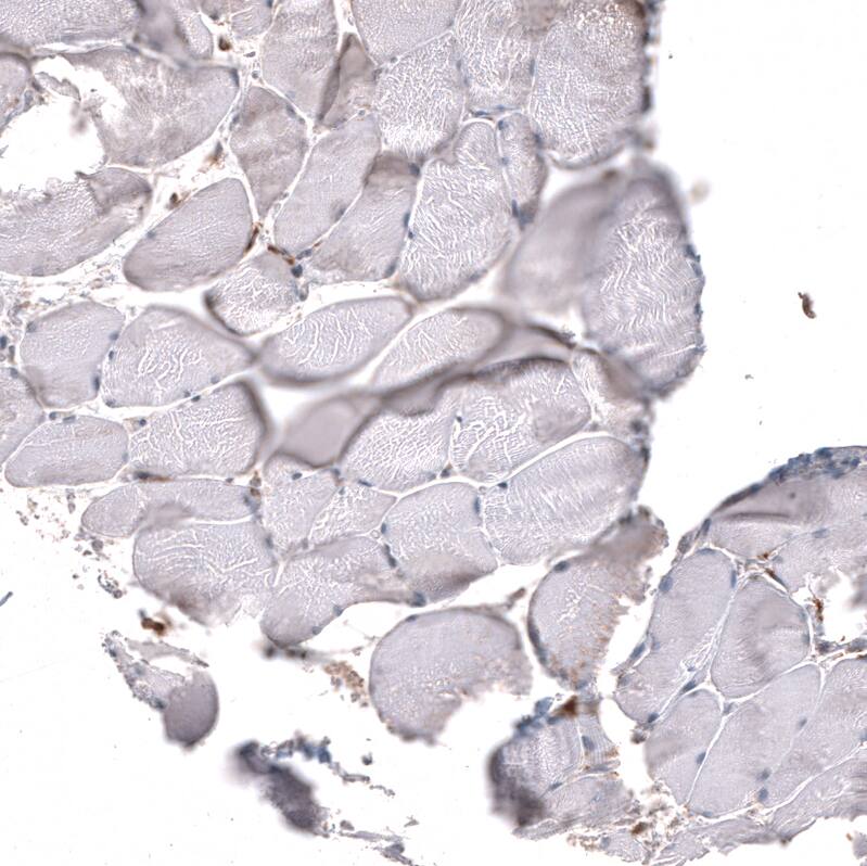 Chitinase 3-like 1/YKL-40 Antibody (CL12241) - Azide and BSA Free Immunohistochemistry-Paraffin: Chitinase 3-like 1/YKL-40 Antibody [NBP3-44298]