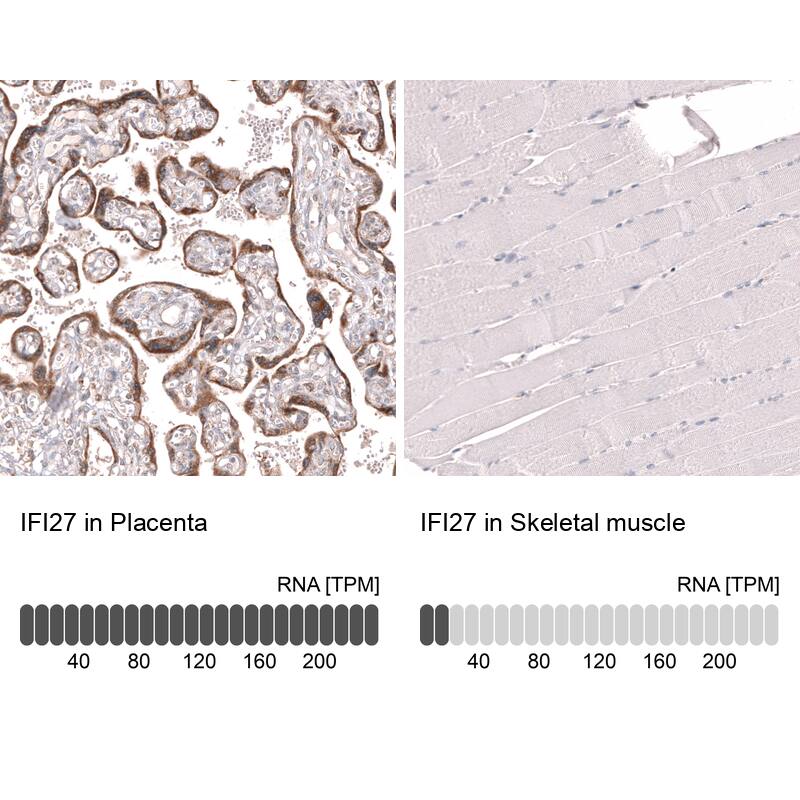 IFI27 Antibody (CL14627) - Azide and BSA Free Immunohistochemistry-Paraffin: IFI27 Antibody [NBP3-44299]