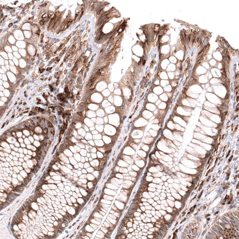 IFI27 Antibody (CL14627) - Azide and BSA Free Immunohistochemistry-Paraffin: IFI27 Antibody [NBP3-44299]