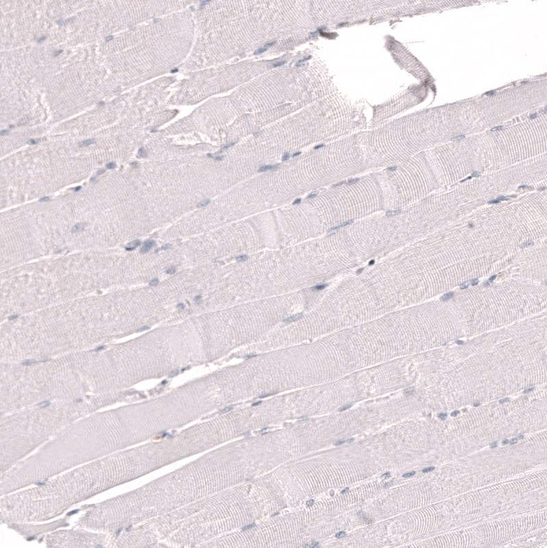 IFI27 Antibody (CL14627) - Azide and BSA Free Immunohistochemistry-Paraffin: IFI27 Antibody [NBP3-44299]