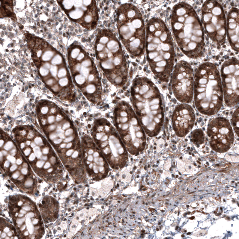 ID1 Antibody (CL11981) - Azide and BSA Free Immunohistochemistry-Paraffin: ID1 Antibody [NBP3-44300]