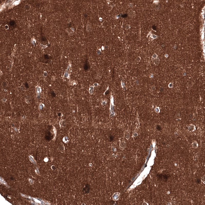 ID1 Antibody (CL11981) - Azide and BSA Free Immunohistochemistry-Paraffin: ID1 Antibody [NBP3-44300]