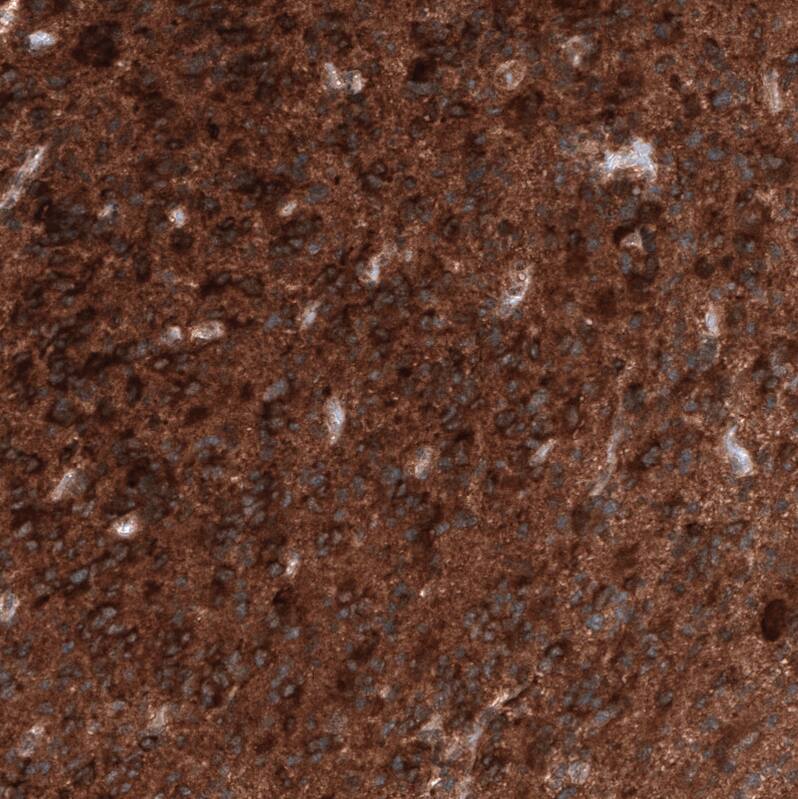 ID1 Antibody (CL11981) - Azide and BSA Free Immunohistochemistry-Paraffin: ID1 Antibody [NBP3-44300]