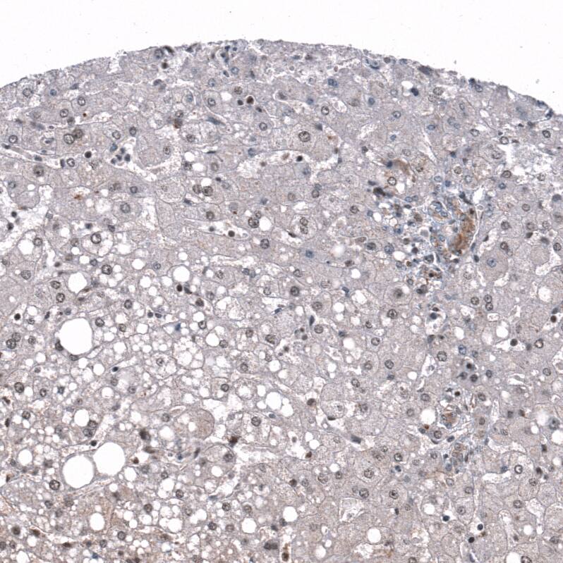 ID1 Antibody (CL11981) - Azide and BSA Free Immunohistochemistry-Paraffin: ID1 Antibody [NBP3-44300]