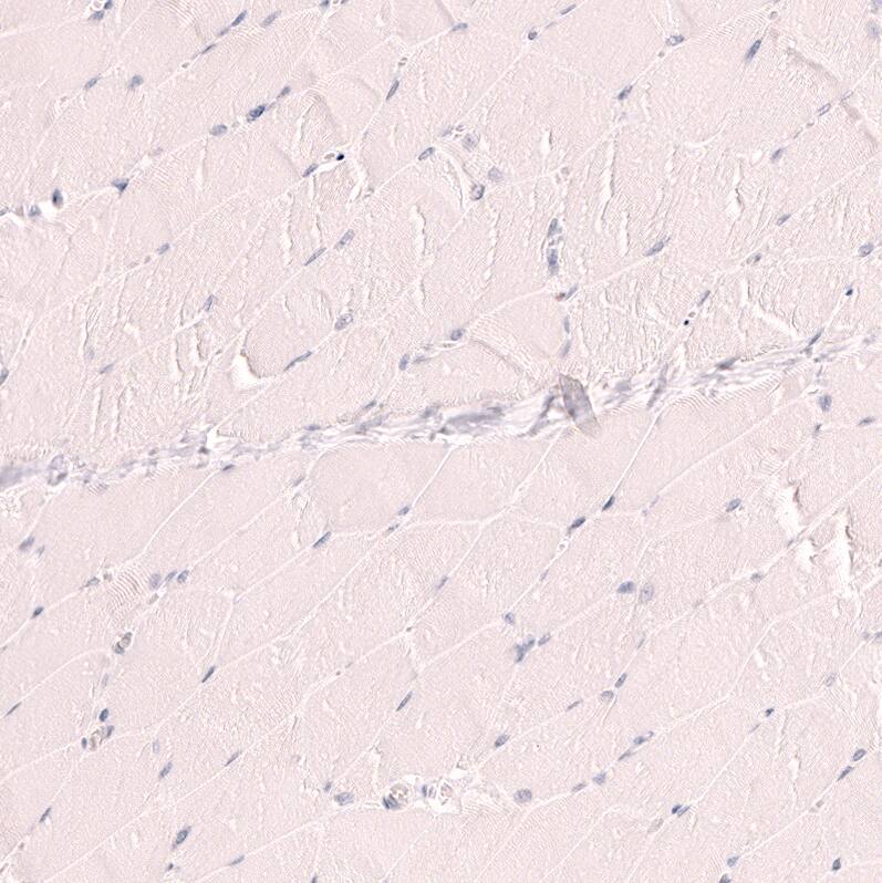 TTF-1 / NKX2-1 Antibody (CL14523) - Azide and BSA Free Immunohistochemistry-Paraffin: TTF-1 / NKX2-1 Antibody [NBP3-44302]