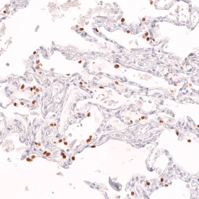 TTF-1 / NKX2-1 Antibody (CL14523) - Azide and BSA Free Immunohistochemistry-Paraffin: TTF-1 / NKX2-1 Antibody [NBP3-44302]
