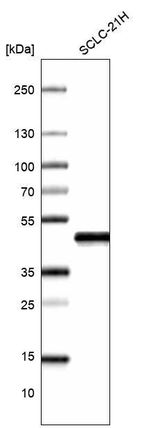 TTF-1 / NKX2-1 Antibody (CL14523) - Azide and BSA Free Western Blot: TTF-1 / NKX2-1 Antibody [NBP3-44302]