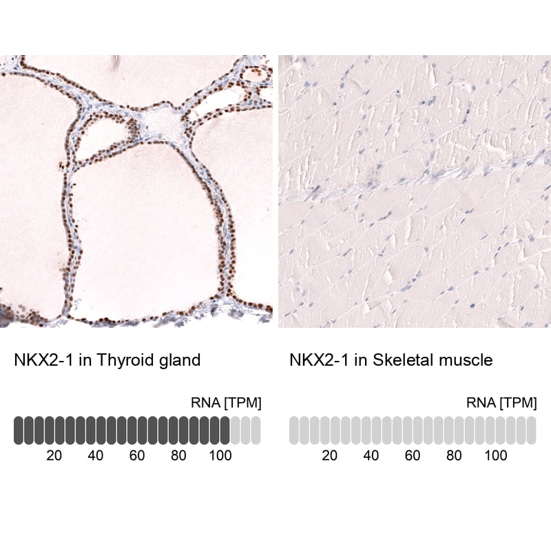 TTF-1 / NKX2-1 Antibody (CL14528) - Azide and BSA Free Immunohistochemistry-Paraffin: TTF-1 / NKX2-1 Antibody [NBP3-44303]
