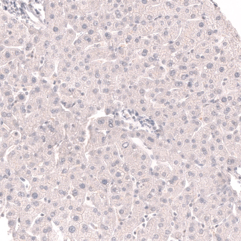 TTF-1 / NKX2-1 Antibody (CL14528) - Azide and BSA Free Immunohistochemistry-Paraffin: TTF-1 / NKX2-1 Antibody [NBP3-44303]