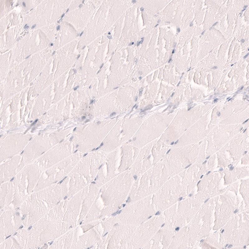 TTF-1 / NKX2-1 Antibody (CL14528) - Azide and BSA Free Immunohistochemistry-Paraffin: TTF-1 / NKX2-1 Antibody [NBP3-44303]