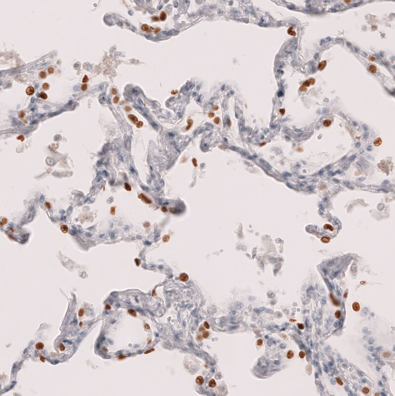 TTF-1 / NKX2-1 Antibody (CL14528) - Azide and BSA Free Immunohistochemistry-Paraffin: TTF-1 / NKX2-1 Antibody [NBP3-44303]