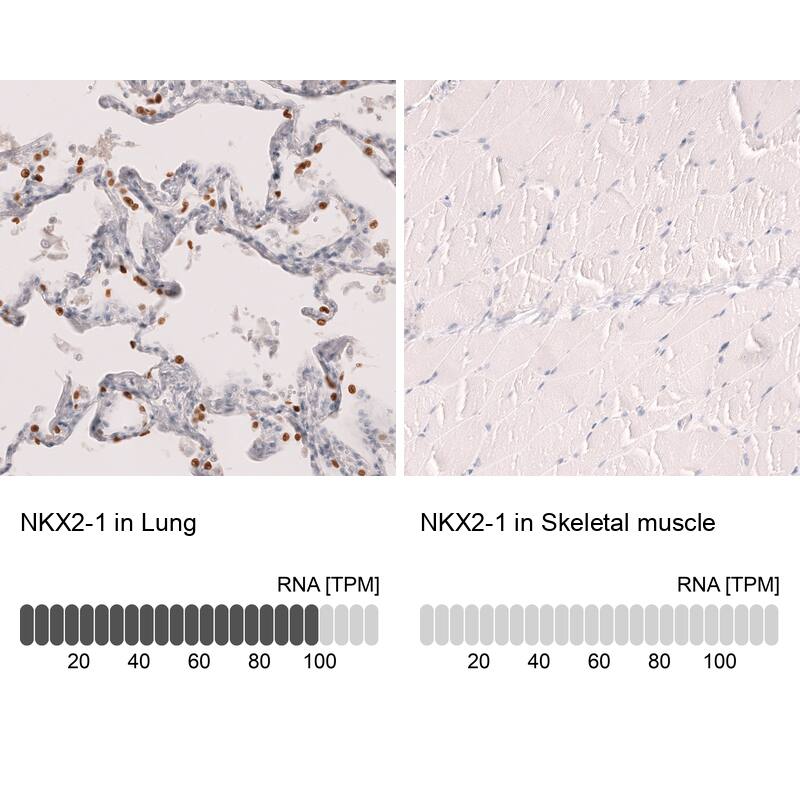 TTF-1 / NKX2-1 Antibody (CL14531) - Azide and BSA Free Immunohistochemistry-Paraffin: TTF-1 / NKX2-1 Antibody [NBP3-44304]