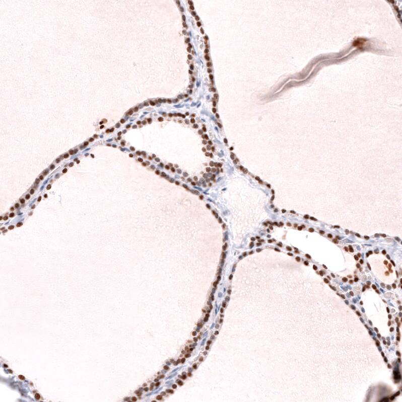 TTF-1 / NKX2-1 Antibody (CL14531) - Azide and BSA Free Immunohistochemistry-Paraffin: TTF-1 / NKX2-1 Antibody [NBP3-44304]