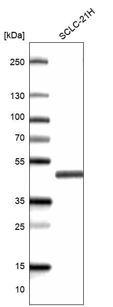 TTF-1 / NKX2-1 Antibody (CL14531) - Azide and BSA Free Western Blot: TTF-1 / NKX2-1 Antibody [NBP3-44304]