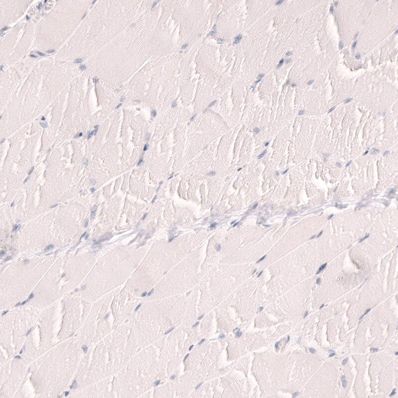 TTF-1 / NKX2-1 Antibody (CL14531) - Azide and BSA Free Immunohistochemistry-Paraffin: TTF-1 / NKX2-1 Antibody [NBP3-44304]