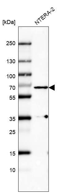 PLK1 Antibody (CL8360) - Azide and BSA Free Western Blot: PLK1 Antibody [NBP3-44307]
